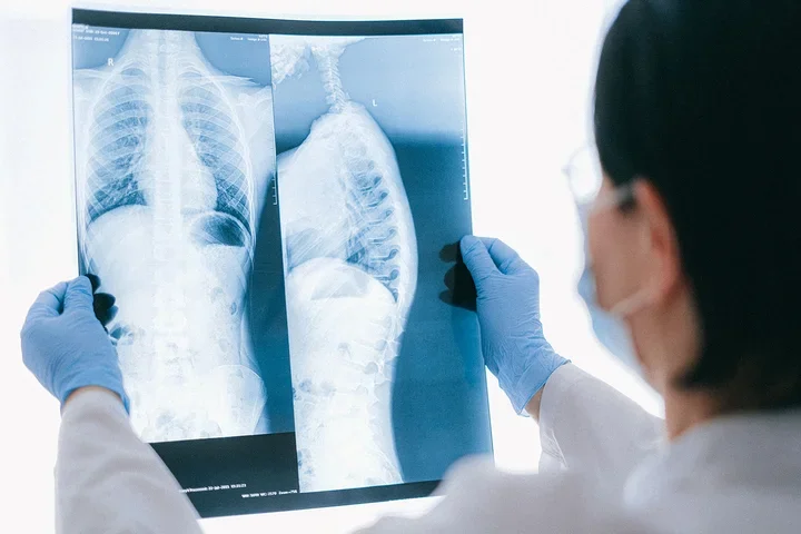A doctor looking at a chest x-ray.